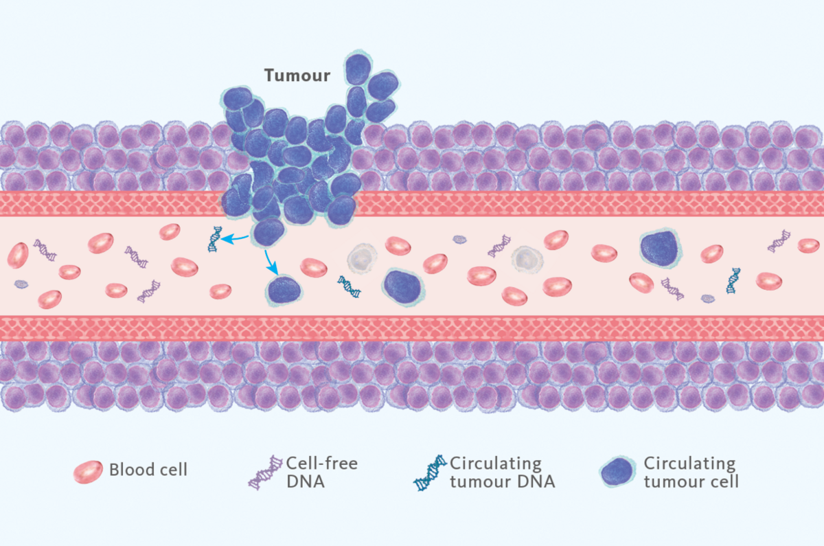 [.CO.UK-en United Kingdom (english)] Liquid biopsy