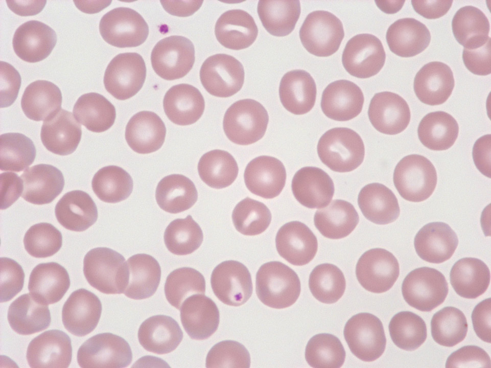 Red blood cells Red blood cells