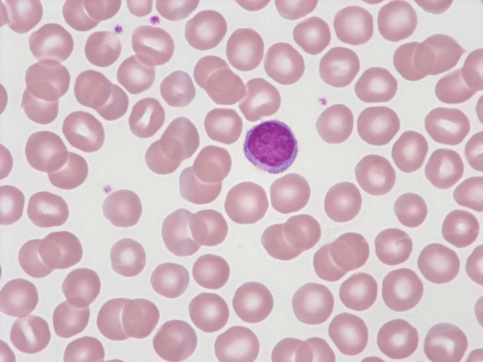 Red blood cells and lymphocyte Red blood cells and lymphocyte