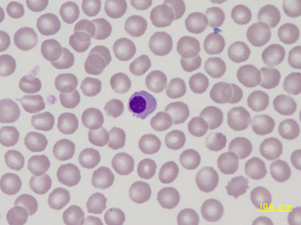 Canine nucleated red blood cell