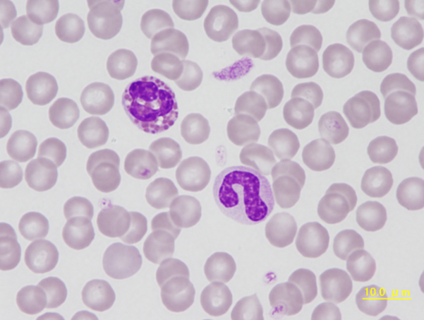 Canine giant platelet, eosinophil and band