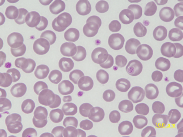 Canine microcytes