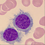 Hairy cells Hairy cells