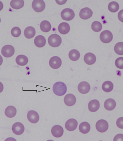 Murine (mouse) red blood cell morphology II