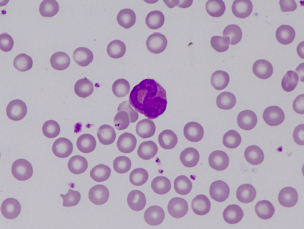 Murine (mouse) eosinophil