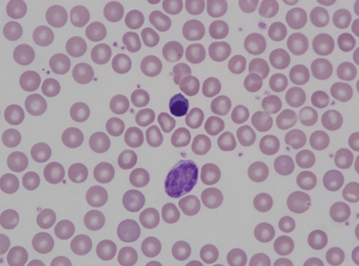 Murine (mouse) erythroblast