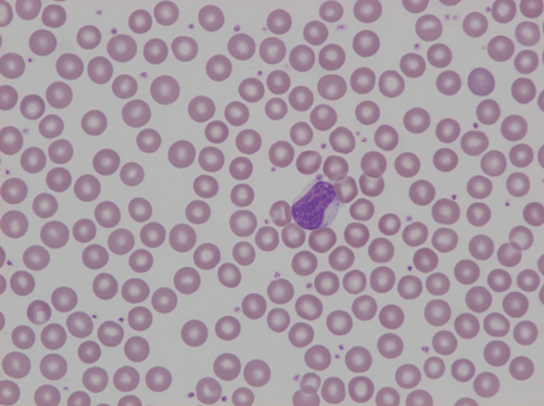 Murine (mouse) giant lymphocyte