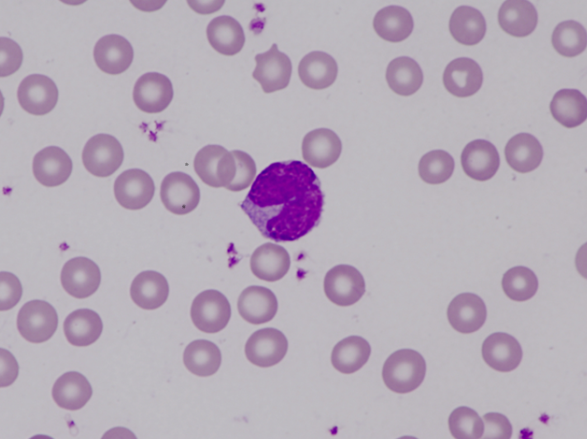 Murine (mouse) monocyte with notch