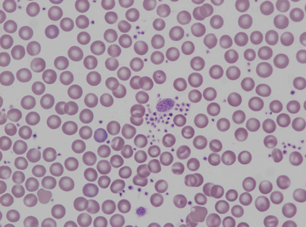 Murine (mouse) – platelet aggregation