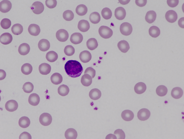 Murine (mouse) small lymphocyte
