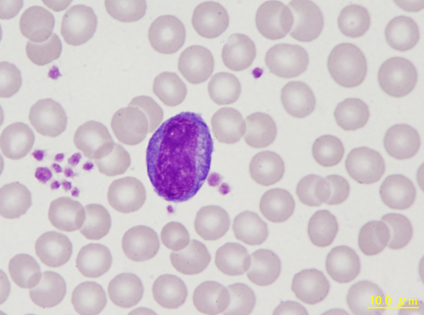 NHP atypical lymphocyte II