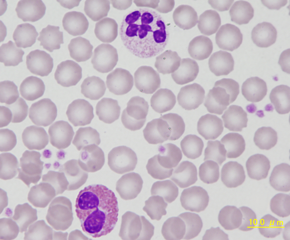 NHP eosinophil - neutrophil comparison