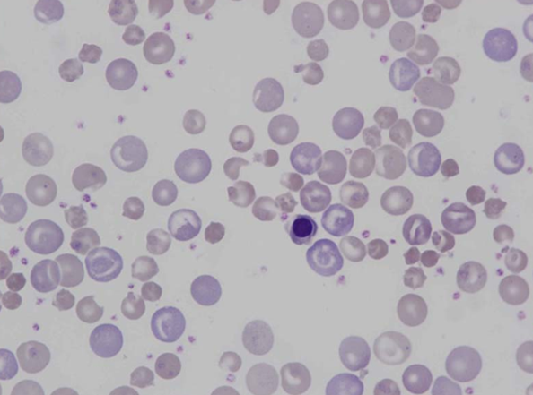 Murine (rat) red blood cell morphology IV