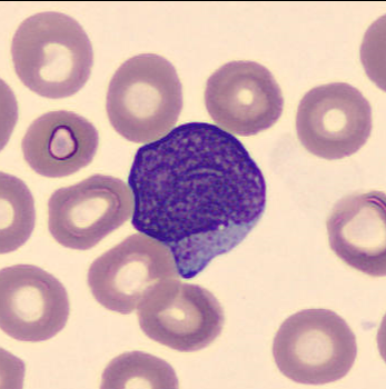 Granulated myeloblast 1 Granulated myeloblast 1