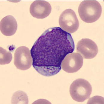 Granulated myeloblast 2 Granulated myeloblast 2